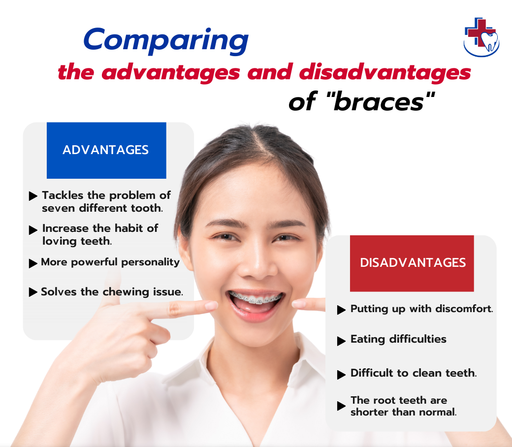 Comparing the advantages and disadvantages of "braces." Chiangmai